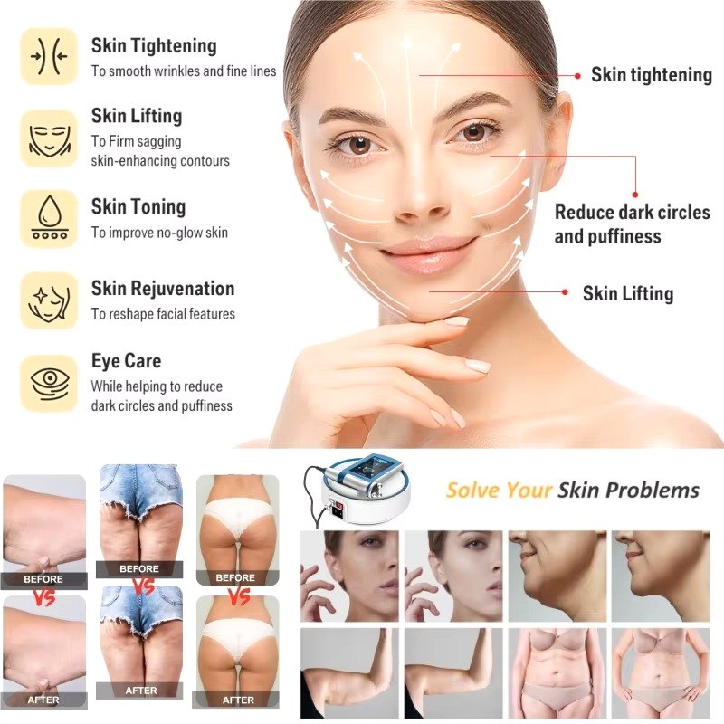 Bio Pen T6 Professional RF LED EMS Skin Lifting Device | Advanced Multi-Technology Skin Treatment