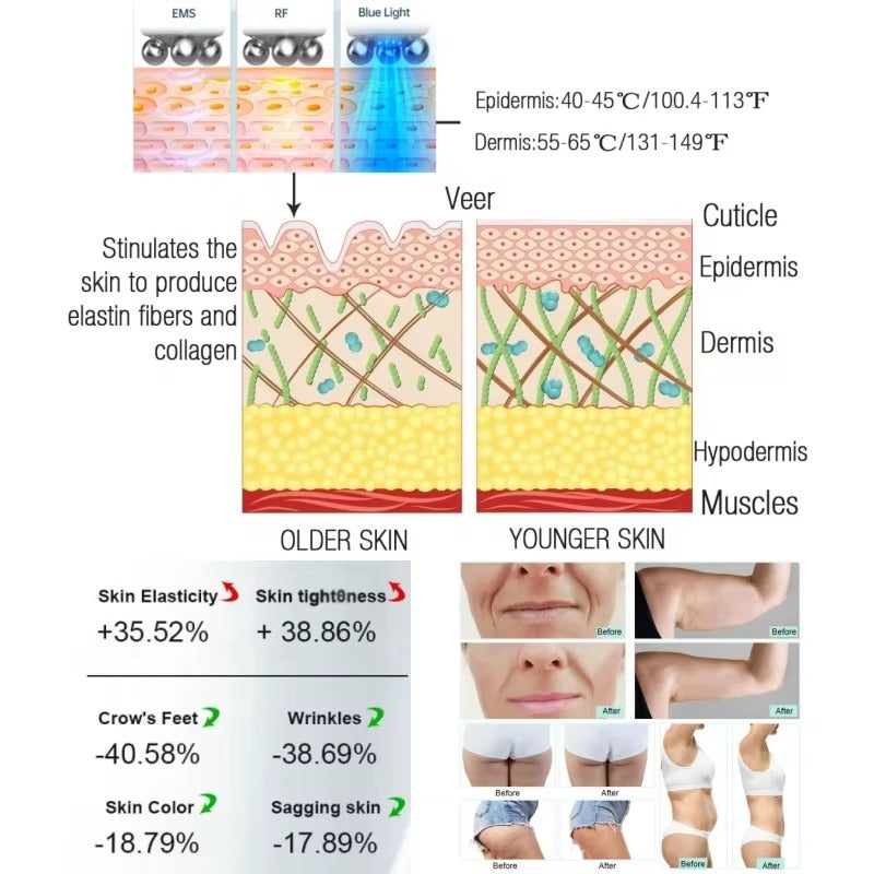 Bio Pen T6 Professional RF LED EMS Skin Lifting Device | Advanced Multi-Technology Skin Treatment