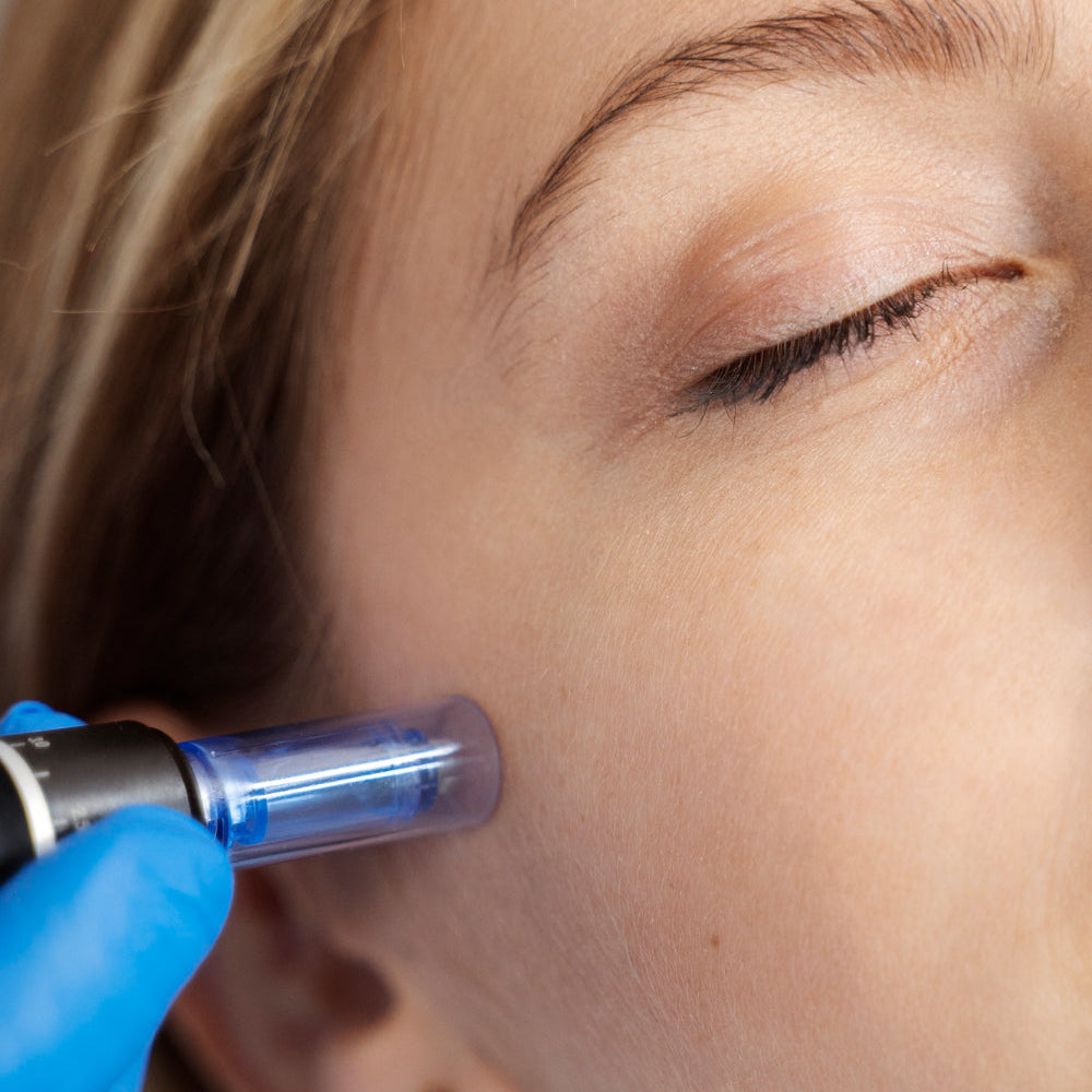 Dr Pen A7 Ultima Wireless Microneedling Pen | Professional Derma Therapy Device